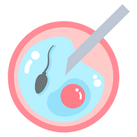 Intracytoplasmic Sperm Injection (ICSI)